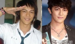 吃瓜整容男,揭秘整容男生的蜕变之路