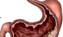 吃籽瓜治胃炎,天然良方助您缓解胃炎困扰