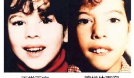 鼻炎吃瓜,轻松缓解不适，享受夏日清凉